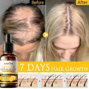 Сыворотка для роста волос с имбирем Масло для быстрого роста волос Восстанавливает и улучшает состояние сухих вьющихся волос, тонизирует кожу головы, делая волосы длиннее и гуще